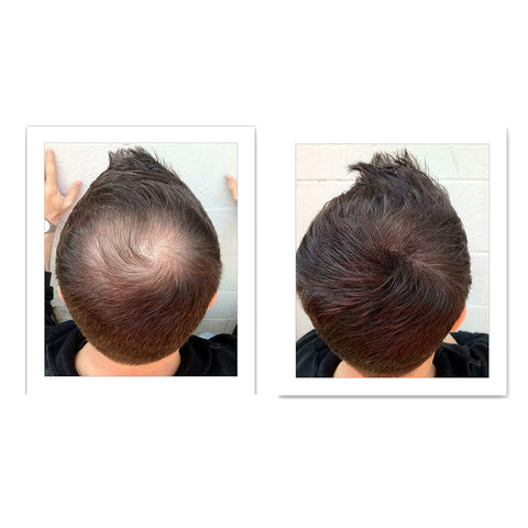 Caboki Hair Building Fiber Light Brown 25g